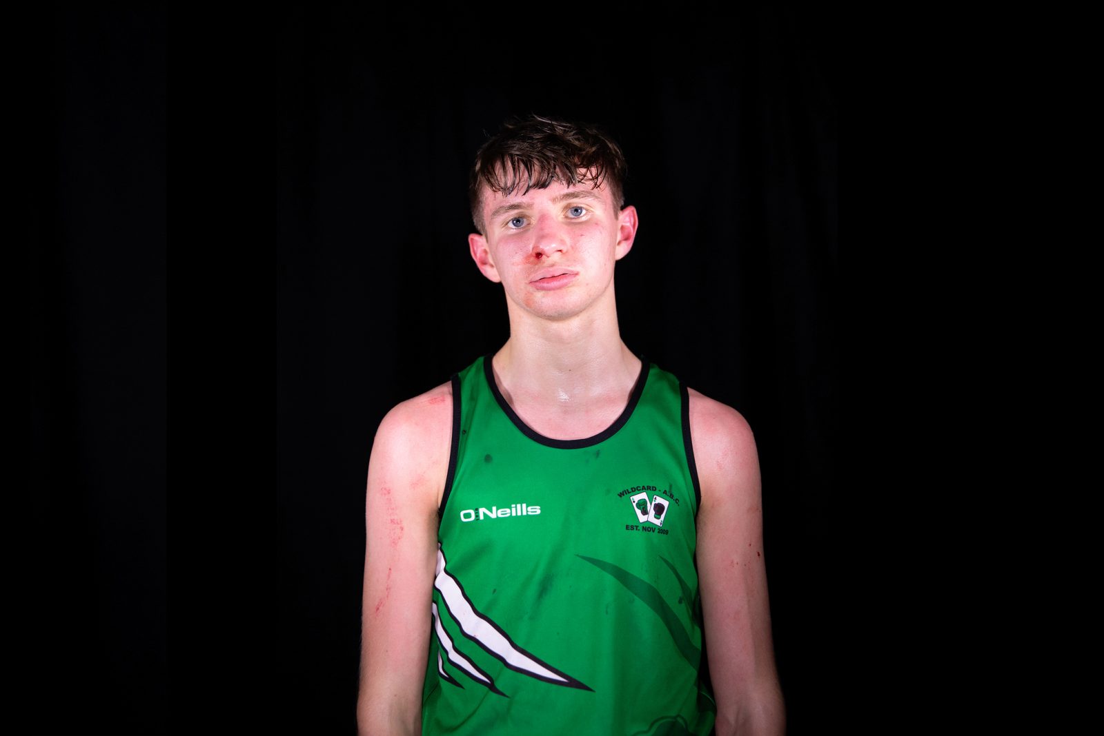 A young person with dark hair, wearing a green sports vest stands looking directly at the camera. They have a bloody nose and they are sweating.